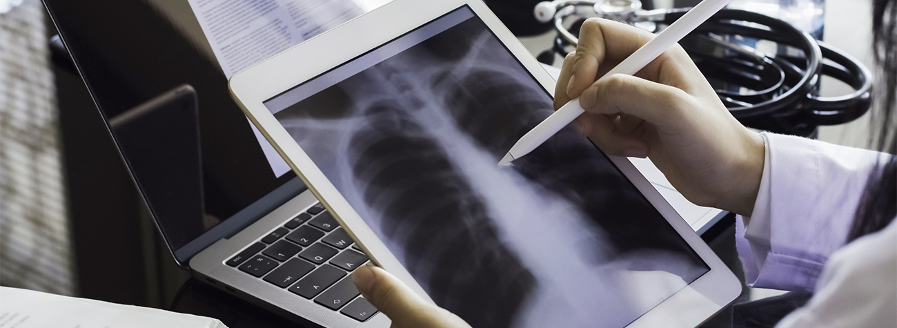 Radiographer examining an x-ray image of the human body on an iPad
