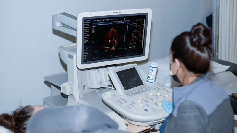 Non-Invasive Cardiovascular Sonography | NICVS | Cardiovascular Sonography